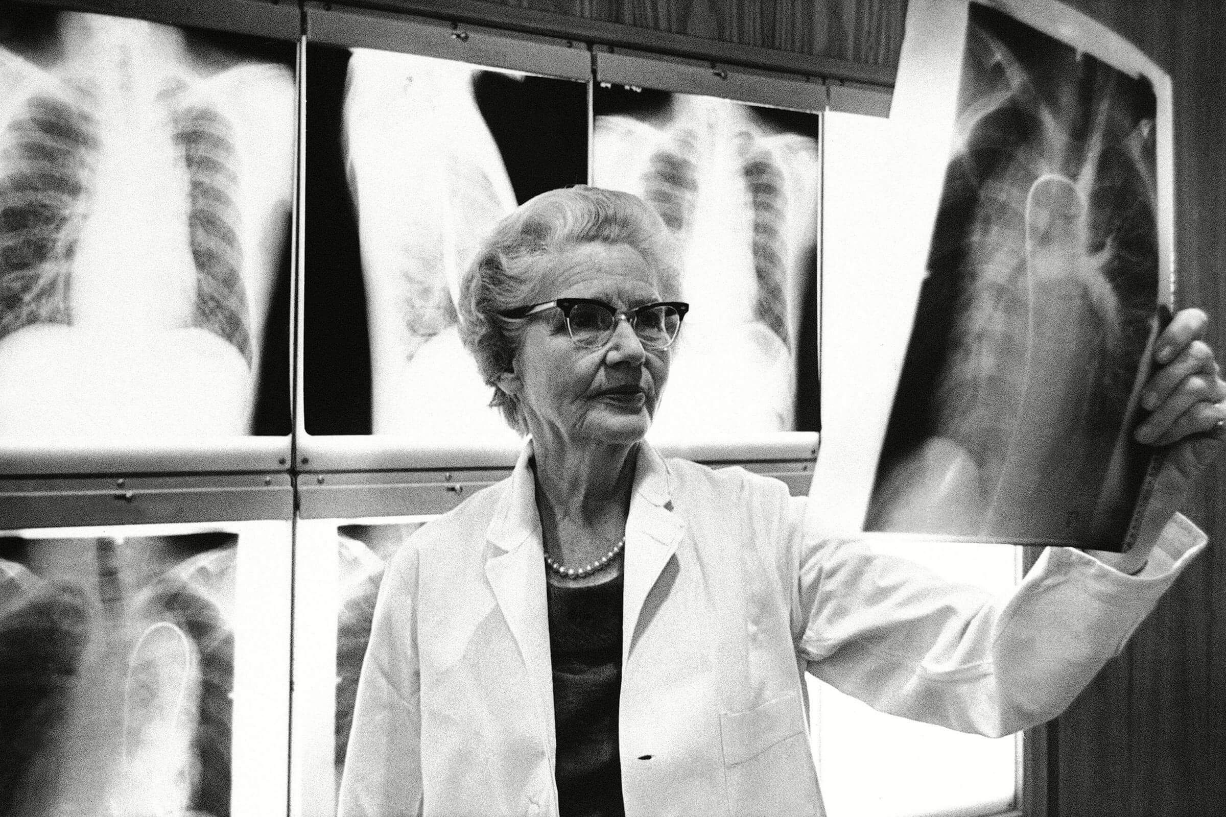 Dr. Helen B. Taussig, co-developer of the blue baby operation, examines an X-ray at Johns Hopkins Hospital in Baltimore, where she is still active at the age of 69. She believes heart transplants one day may save infants born with severely malformed hearts